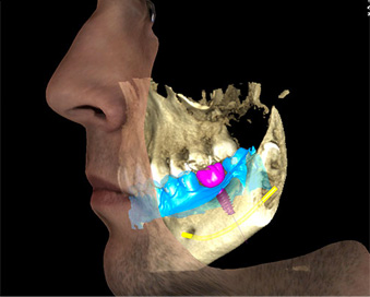 imagerie dentaire en 3D